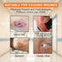 Carbou Silicone Foam Dressing with Gentle Border, 4"x4" Adhesive Waterproof Bandage for Pressure Sore, 10 Pack