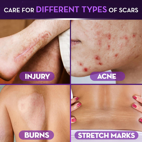 Cicatricure Advanced Scar Gel for Face & Body, Proven Results in 2 Weeks, 1 oz, Scar Treatment for Various Scars