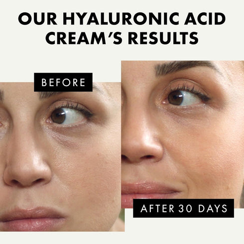 Hyaluronic Acid Face Moisturizer for Women and Men, Anti-Aging Hydrating Cream, Day and Night Facial Lotion