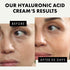 Hyaluronic Acid Face Moisturizer for Women and Men, Anti-Aging Hydrating Cream, Day and Night Facial Lotion
