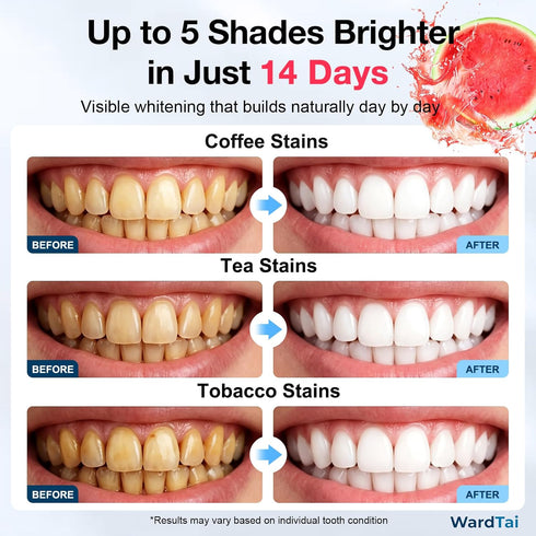 WardTai 30 28 Whitening Strips for Sensitive Teeth with Low Concentration Hydrogen Peroxide Formula for Gentle