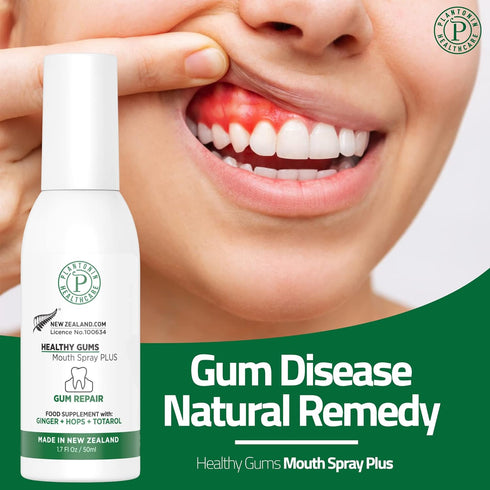 Oral Rinse Spray for Gum Disease and Gingivitis Treatment - 50ml, Alcohol Free Natural Toothpaste Alternate