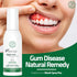Oral Rinse Spray for Gum Disease and Gingivitis Treatment - 50ml, Alcohol Free Natural Toothpaste Alternate