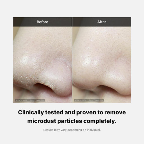 Medicube Zero Foam Cleanser for Sensitive Skin - Korean Skincare, Sebum Control, Moisture Balance, Pore Minimization