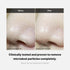 Medicube Zero Foam Cleanser for Sensitive Skin - Korean Skincare, Sebum Control, Moisture Balance, Pore Minimization