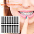 1040 Pcs Black Braces Rubber Bands, Orthodontic Ligature Ties O-Rings Elastic Bands for Braces
