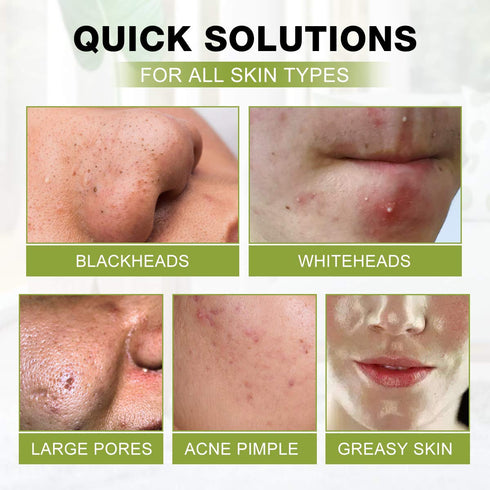 SHVYOG Blackhead Peel Off Face Mask - 3-in-1 Remover with Brush & Tea Tree Oil Serum, Charcoal Mask (100g+30ml)
