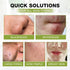 SHVYOG Blackhead Peel Off Face Mask - 3-in-1 Remover with Brush & Tea Tree Oil Serum, Charcoal Mask (100g+30ml)