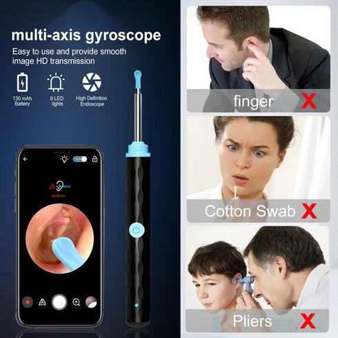 vasdaren 1296P, 9 Set 8 Ear Wax Removal, Ear Wax Removal Tool Camera Built-in Easy and Safe Ear Cleaning, Earwax