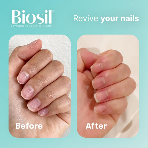 Biosil Collagen Generator - 60 Capsules with Patented ch-OSA Complex - Protects Your Own Collagen - GMO Free