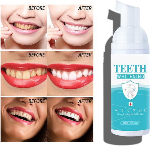 YG LianKai 2PCs Teeth Whitening Mousse Foam Refreshing Breath Deep Cleaning Toothpaste,Fresh Breath,Ultra-fine Mousse