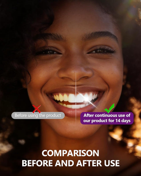 UPWIOY 14 Teeth Whitening Strips, Treatments Purple Whitening Strips, Pap Formula Teeth Whitening Kit for Deep Stains
