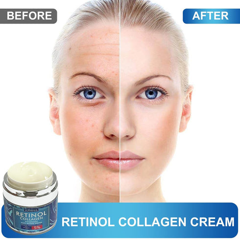 Retinol Cream for Face - Anti-Wrinkle Moisturizer with Collagen, Hyaluronic Acid, Vitamin C+E for Men Women