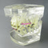 Dental Malocclusion Orthodontic Treatment Teeth Model with Metal Brackets, Colorful Ties, and Chains