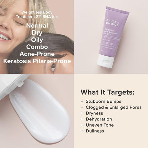 Paula's Choice Weightless Body Treatment 2% BHA, Salicylic Acid & Chamomile Lotion for Keratosis Pilaris (2 Oz)