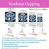 Koukone Sets 4pcs Professionals Silicone Cupping Therapy Massage Cups Vacuum Cupping Cups Massage Jars - Deep Tissue