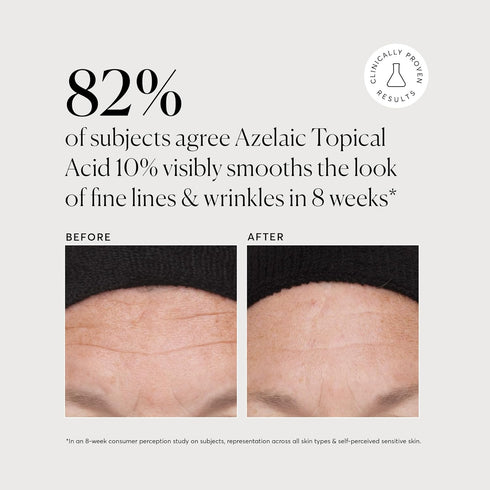 Naturium Azelaic Topical Acid 10%, Face & Skin Care Treatment with Niacinamide & Vitamin C, 1 oz