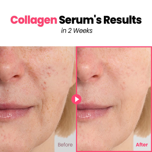 GLAM UP Plump Nourishing Marine Collagen Serum - Anti-Aging Facial Serum with Hyaluronic Acid & Peptide Complex, 30ml