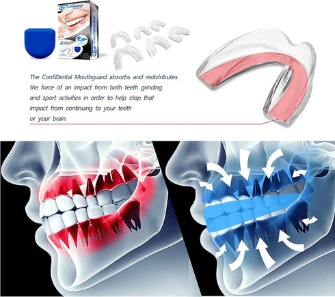 Mouth Guard for Grinding Teeth at Night, Pack of 6 Moldable Dental Night Guards for Clenching and Grinding