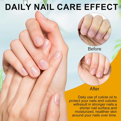 NXJ INFILILA Cuticle Oil 30ml for Nails, Hydrating Nail Oil for Growth and Strength, Simple Natural Ingredients (Milk &