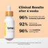Timeless Skin Care Argan Oil - 100% Pure for Face & Hair Care - Fragrance-Free, 1 oz - For Dry Skin