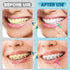 120 Pieces Interdental Brushes for Teeth, Braces Toothbrush Flossers Cleaner Dental Hygiene Tools