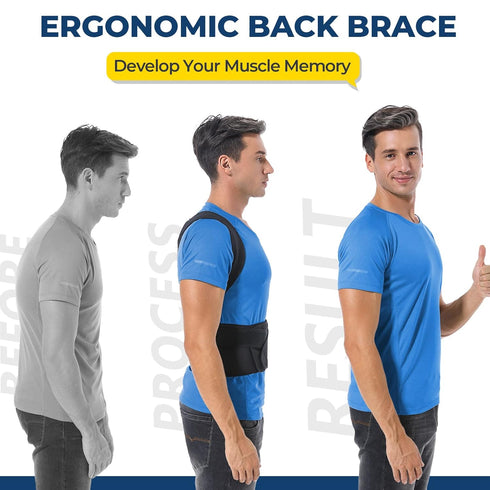 Back Brace Posture Corrector for Women and Men, Adjustable Support for Upper and Lower Back Pain Relief (XL,