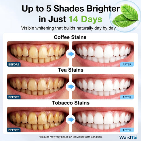 WardTai 30 14 Whitening Strips for Sensitive Teeth with Low Concentration Hydrogen Peroxide Formula for Gentle