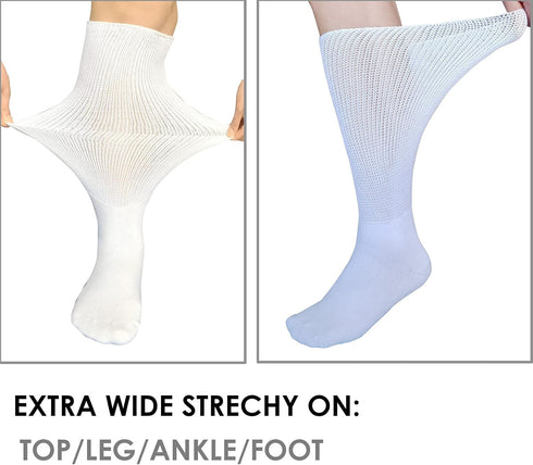 2 Pairs Replacement Socks for Air Cast Walking Boot Walker Brace, Orthopedics Socks for Fracture Boot