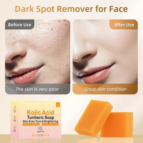 Kojic Acid Turmeric Soap Bar - Dark Spot Remover for Face, Even Skin Tone, Moisturizing & Nourishing Natural