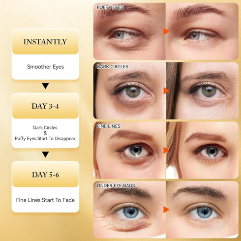 Under Eye Patches for Dark Circles, 60Pcs Eye Mask for Anti Aging, 24K Gold Gel Pads with Collagen for Puffy Eyes