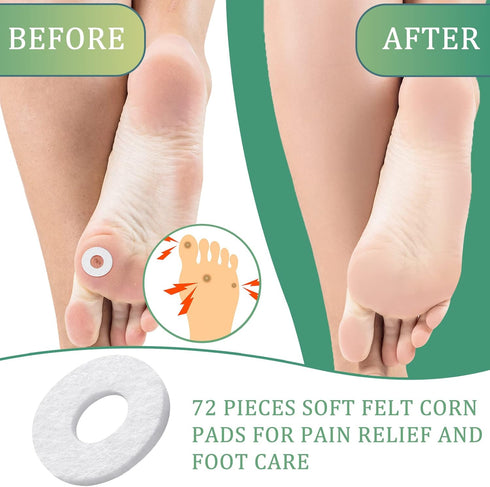 Nuanchu 72 Pcs Callus Cushions Pads for Feet, Soft Adhesive Felt Corn Pads for Pain Relief from Shoe Pressure