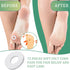 Nuanchu 72 Pcs Callus Cushions Pads for Feet, Soft Adhesive Felt Corn Pads for Pain Relief from Shoe Pressure