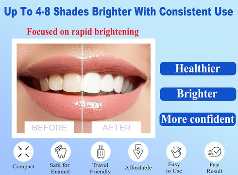 MEDIWHITE Professional Teeth Whitening Kit with Teeth Whitener Pen & Remineralization Gel Pen for Sensitive Teeth