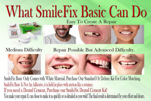 SmileFix Basic Dental Repair for Missing or Damaged Teeth - Fast & Easy Repairs - Durable Compound - Confident Smiles