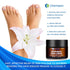 Ingredients-50g Athletes Foot Treatment-Antifungal Cream-Treatment for Jock Itch,Ringworm, Psoriasis,Eczema,Rash-Anti