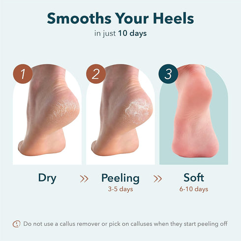 Purederm Exfoliating Heel Mask - 1 Pair Heel Peeling Masks to Gently Remove Calluses