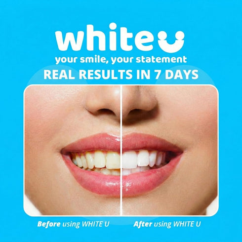 WhiteU 14 7 Teeth Whitening Strips for Sensitive Teeth - Peroxide Free No Sensitivity - Strips with Pap+ & Nano