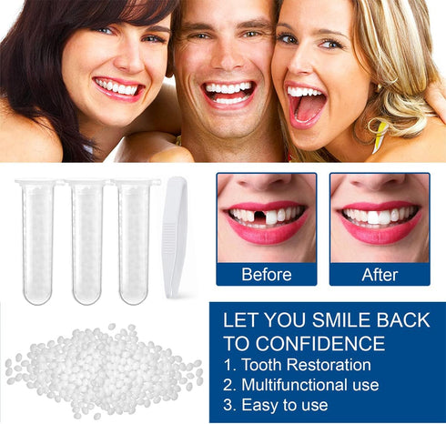 Tooth Repair Kit - Fake Teeth Replacement Kit with Moldable Thermal Fitting Beads for Missing and Broken Tooth