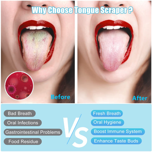 MORGLES Copper Tongue Scraper, 4Pcs Medical Grade Tongue Scrapers with Case for Adults & Kids, Gold