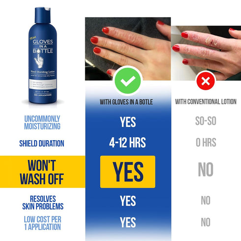 Gloves In A Bottle Psoriasis Eczema Relief Cream, Shielding Lotion for Cracked Hands, 8 oz with Pump