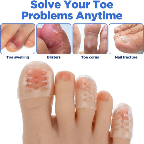 SHENLIU 30-Pack Women's Toes Protectors, Silicone Toe Protector, Soft and Transparent Small Toe Protector, Gel