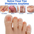SHENLIU 30-Pack Women's Toes Protectors, Silicone Toe Protector, Soft and Transparent Small Toe Protector, Gel