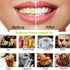 Teeth Whitening Charcoal Powder, Natural Coconut Whitener for Oral Care, No Hurt on Enamel or Gum (2)