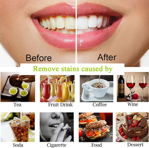 Teeth Whitening Charcoal Powder, Natural Coconut Teeth Whitener Oral Care Set, No Hurt on Enamel or Gum (1)