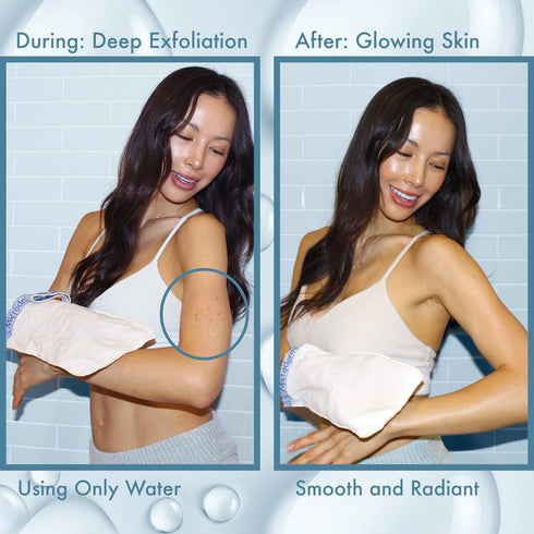 MicrodermaMitt Deep Exfoliating Mitt for Shower, Premium Dead Skin Remover & Exfoliator Body Scrubber, Turkish Kese