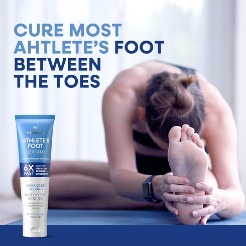 Hermon Athletes Foot Treatment Cream Extra Strength Antifungal for Cracked Heels, Dry Skin & Itchy Feet Soothes