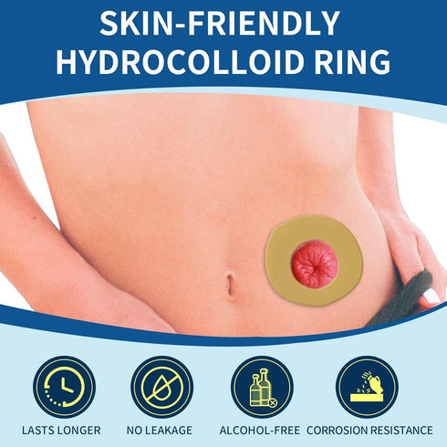 ovand 2 mm 10) Ostomy Barrier Rings - Ostomy Supplies - Thickness Moldable Ostomy Rings Medical Grade Hydrocolloid