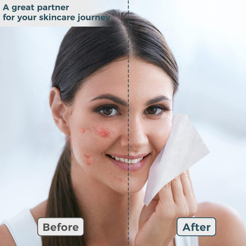 ourmed life 50 Count Disposable Face Towel | Lint-Free Biodegradable Makeup Remover Wipes | Super Soft & Thick, 10x12 in