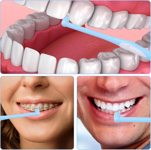 4 Pieces Tuft Toothbrush, Tufted End Tapered Trim Toothbrush for Orthodontic Braces, Compact Interdental Cleaning